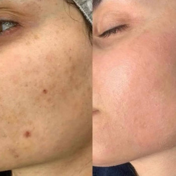 Севера Юнусовна, Shymkent Фото - 6