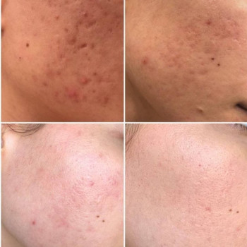 Сабина Кхехиматова, Shymkent Фото - 5