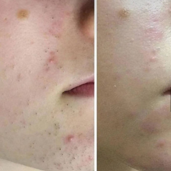 Олеся Бесчаснова, Shymkent Фото - 5