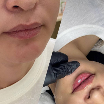 Аружан Абдырахманова, Shymkent Фото - 7