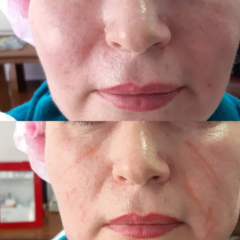 Азима Хусеймовна, Shymkent Фото - 5