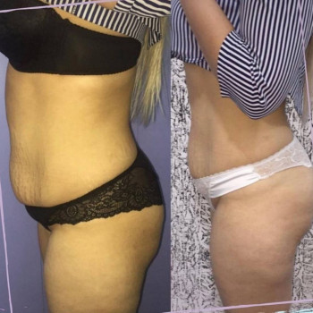 Жанна Исмаиловна, Шымкент Фото - 5