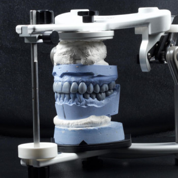 Женис Разметов, Шымкент Фото - 5