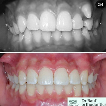 Рауф , Shymkent Фото - 5