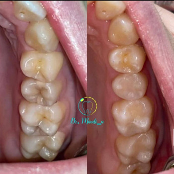 Нодира Мухамеджанова, Шымкент Фото - 5