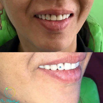 Нодира Мухамеджанова, Шымкент Фото - 6