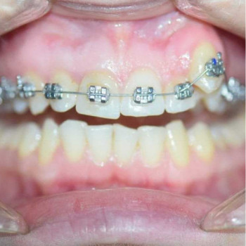 Умид , Shymkent Фото - 5