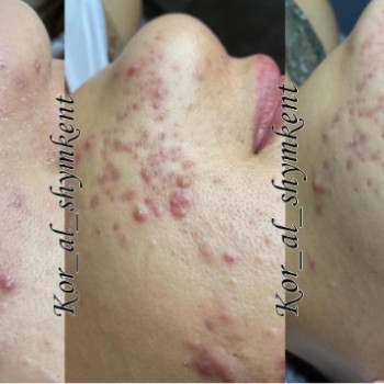 Kor al, Шымкент Фото - 5