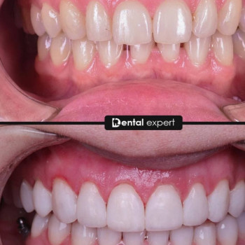 Dental Expert, Шымкент Фото - 5