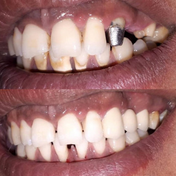 Улыбка , Шымкент Фото - 5