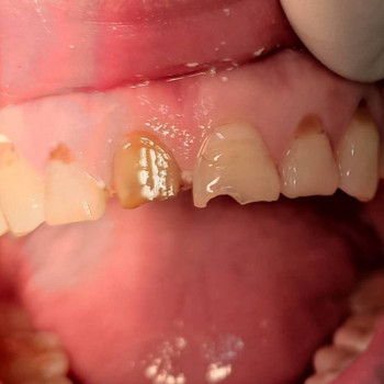 Улыбка , Шымкент Фото - 6