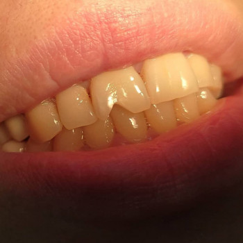 Улыбка , Шымкент Фото - 7