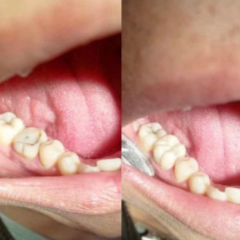 Диагностика зубов