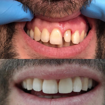 Said dent, Shymkent Фото - 5