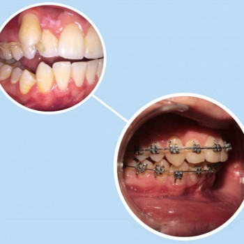 Cosmo dent, Шымкент Фото - 5