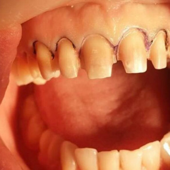 Дентис, Шымкент Фото - 5