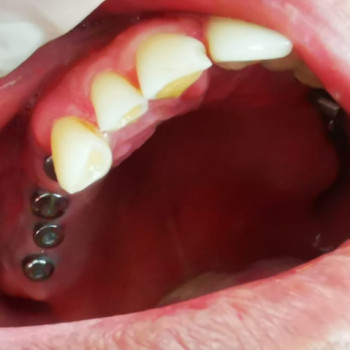 Дентис, Шымкент Фото - 6