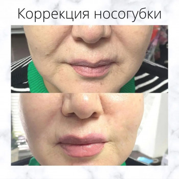 Гульназ Турдахова, Almaty Фото - 5