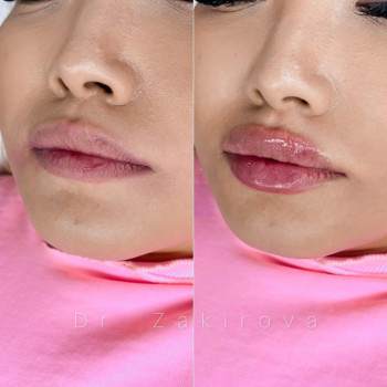 Наргиз Закирова, Алматы Фото - 5