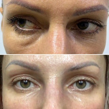 Динара Есжанова, Алматы Фото - 5