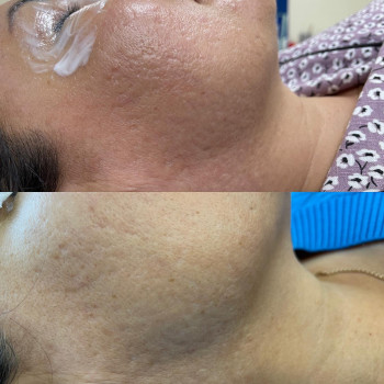 Оксана Доронкина, Almaty Фото - 5