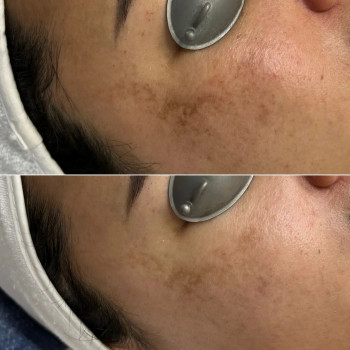 АруМед, Алматы Фото - 6