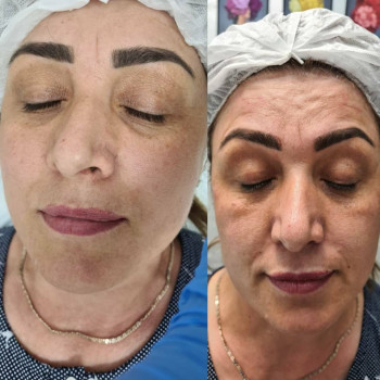 Милана Московская, Алматы Фото - 5