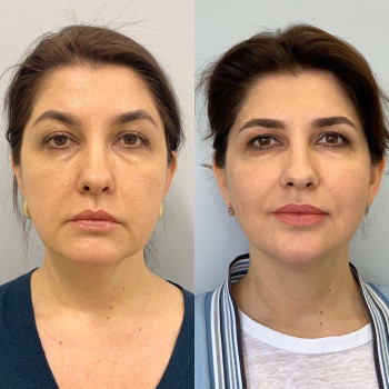 Екатерина Евгеньевна Венедиктова, Алматы Фото - 5