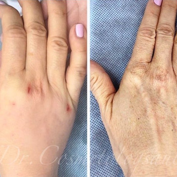 Сауле Нурхатовна Чанчарова, Almaty Фото - 5