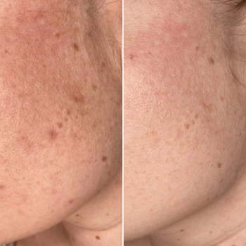 Жанар Биназарова, Almaty Фото - 5