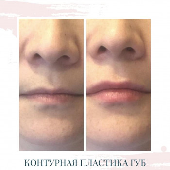 Галина Заросиленко, Алматы Фото - 5