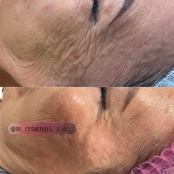 Камила Амантаевна, Almaty Фото - 5