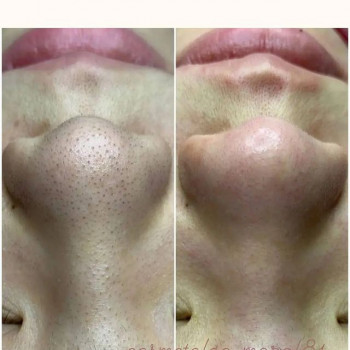 Марал Жакыпбековна , Almaty Фото - 6