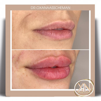 Оксана Анатольевна Асшеман, Almaty Фото - 5