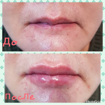 Зулейха Розыбакиева, Алматы Фото - 5