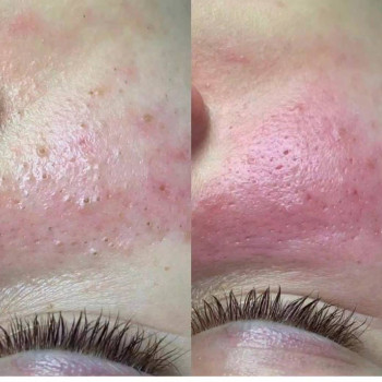 Нинель Азарова, Казань Фото - 6