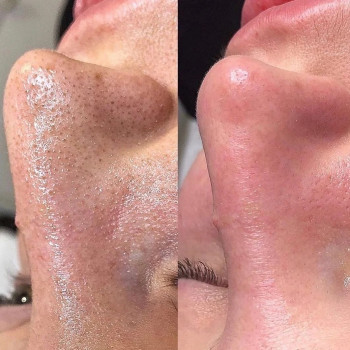 Енлик Муратбековна Сламбекова, Алматы Фото - 5