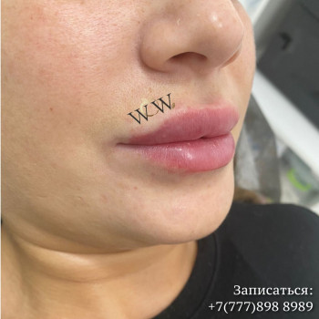 WoW.Dr.Vesta, Алматы Фото - 5