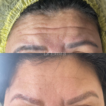 Эльмира Магомедовна Гусейнова, Алматы Фото - 5