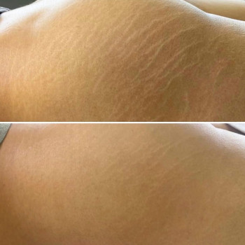  Esthetiks, Almaty Фото - 5