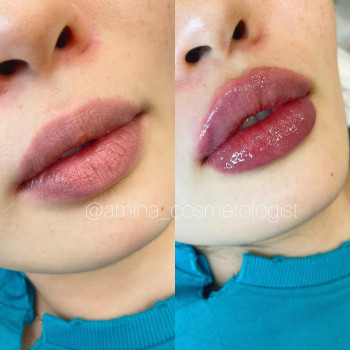 Амина Ибрагим, Алматы Фото - 5