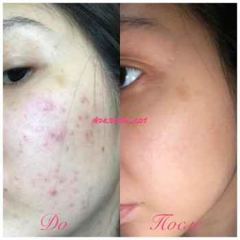 Бота Жумабекова, Almaty Фото - 5