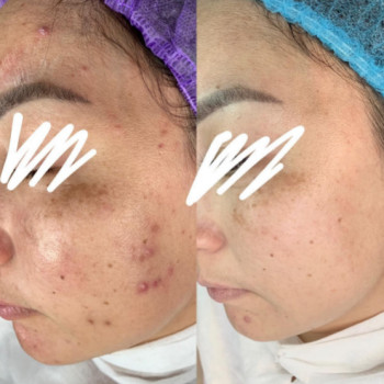 Альмира , Aktobe Фото - 5