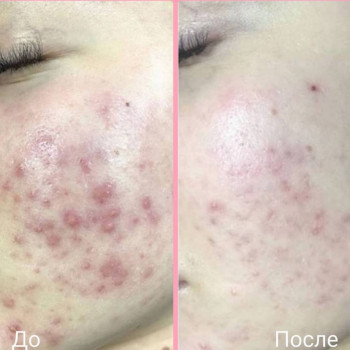 Сауле Жумабековна, Актобе Фото - 6