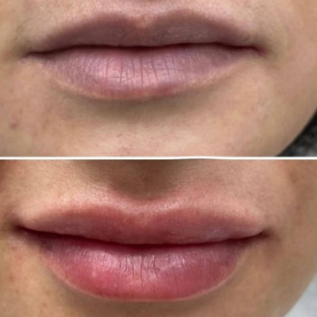 Ляззат , Aktobe Фото - 5