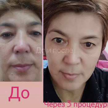 Шинар , Aktobe Фото - 6