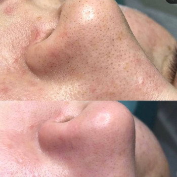 Ильмира , Aktobe Фото - 5