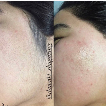 Айдана , Актобе Фото - 7