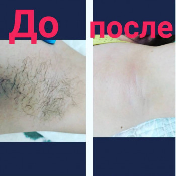 Улмекен , Актобе Фото - 5