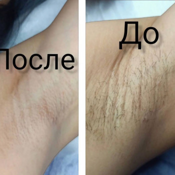 Улмекен , Актобе Фото - 7